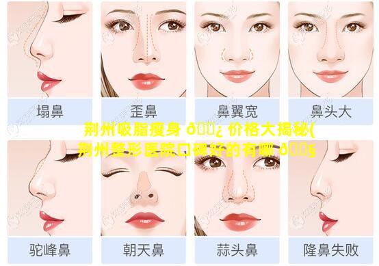 荆州吸脂瘦身 🌿 价格大揭秘(荆州整形医院口碑好的有哪 🐧 些)